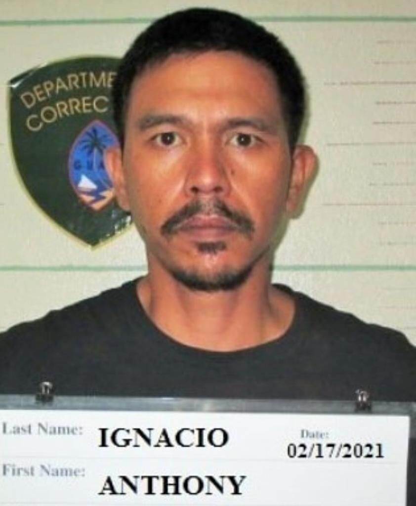 Anthony Ignacio
